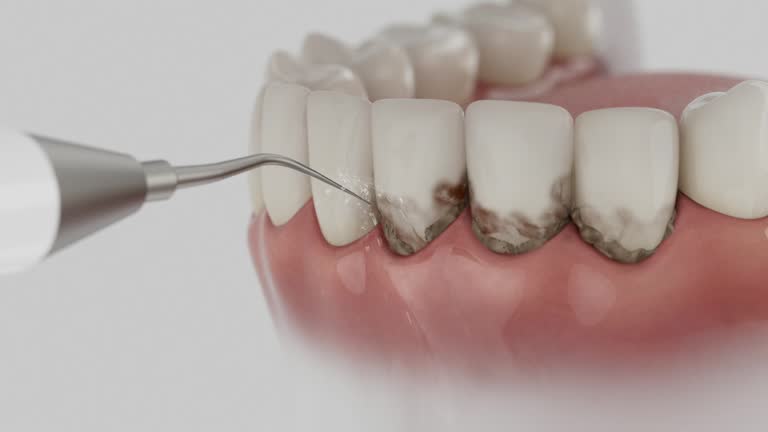 Trusted Teeth Cleaning And Checkup service in Havelock, NC - Dentist Open Now